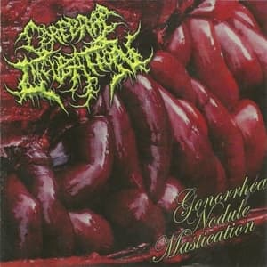 Gonorrhea Nodule Mastication