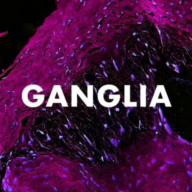 Ganglia