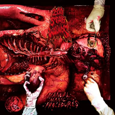 Manual Manic Procedures