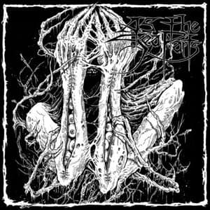 Psychosis