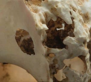 Il Corpo Nel Sogno
