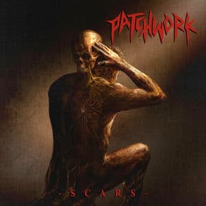 Scars
