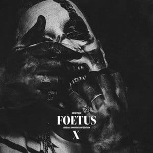 Foetus